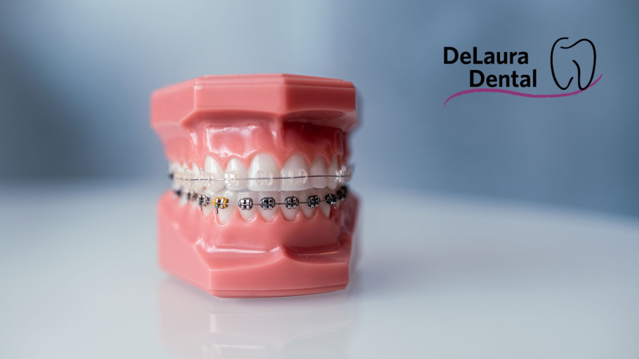 Metal Dental Braces
